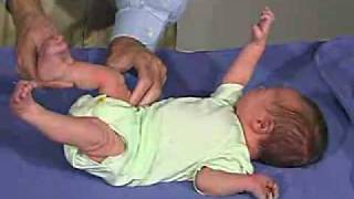 physical exam Newborn Normal TonePopliteal Angle [upl. by Derriey]