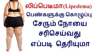 லிப்பெடீமாLipedema பெண்களுக்கு கொழுப்பு சேரும் நோயை சரிசெய்வது எப்படி தெரியுமா [upl. by Rednael904]