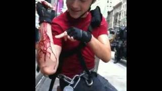 Joseph Gordon Levitts Bloody Bike Accident on the Set of Premium Rush [upl. by Grier444]