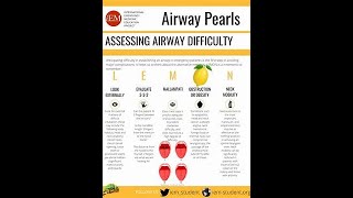 Airway Assessment [upl. by Sinnard]