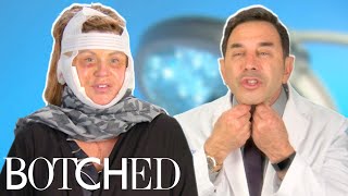 Dr Nassif Fixes Lisa’s Facelift Gone Wrong FULL TRANSFORMATION  Botched  E [upl. by Gleason]