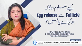 Understanding Ovulation to know when the Egg release from Folicle  Dr Naila Jabeen  Gynae Solution [upl. by Given]