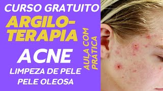 ACNE PELE OLEOSA LIMPEZA DE PELE [upl. by Jeremiah]