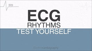 ECG Rhythms for selfassessment Test ECG Interpretation Skills [upl. by Corvese684]