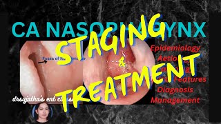 201Nasopharyngeal Carcinoma Part 33 Staging and Treatment clinicalexamination [upl. by Tsepmet]