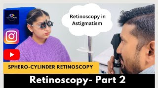 Retinoscopy Part 2  Static Retinoscopy for astigmatism  SpheroCylinder method [upl. by Nodaj808]