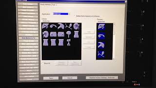 siemens acuson s3000 configration [upl. by Asseneg]