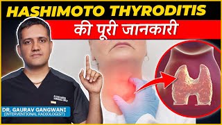 Complete Information About Hashimoto thyroiditis  Dr Gaurav Gangwami Interventional Radiologist [upl. by David]