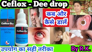 Ceflox Dee drop ke fayade  ceflox d eye ear drop uses in hindi  ciplox Dee eye ear drop uses  opt [upl. by Ardnic]