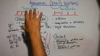 CVS physiology 45What is Tachycardia and bradycardia causes of sinus tachycardia and bradycardia [upl. by Buxton]