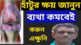 হাঁটুর ক্ষয় রুখতে ও ব্যাথা কমাতে এই কাজটি করুন Prevent Arthritis and knee Pain [upl. by Leonard817]