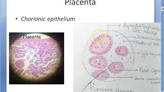 Obstetrics 243 GESTATIONAL TROPHOBLASTIC DISEASES Placental tumor Hydatidiform Mole Choriocarcinoma [upl. by Zere]