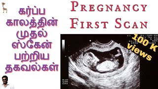 Know about your Pregnancy First Scan  Tamil [upl. by Sagerman830]