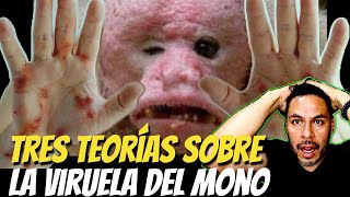 OMS declara Alerta Internacional por VIRUELA DEL MONO  ¿Qué PASA EN VERDAD [upl. by Nosduj45]