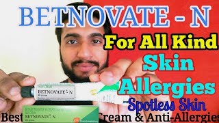 BETNOVATE  N Cream  AntiAllergy Cream  Best For psoriasis and dermatitis  Betamethasone  Hindi [upl. by Bobseine474]