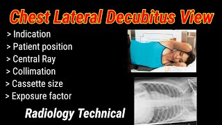 Chest lateral Decubitus View  Right amp Left decubitus  By BL Kumawat [upl. by Nyraf]