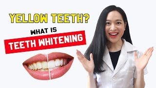 Removing stains Whitening Here to answer your dental questions [upl. by Uda415]