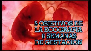 IMPORTANCIA DE LA ECOGRAFÍA 8 SEMANAS DE GESTACIÓN [upl. by Sirret666]