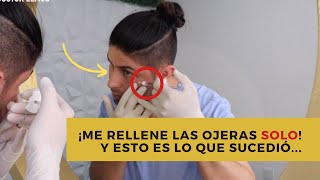 ¡Me aplico RELLENO DE OJERAS yo SOLO 😱  DOCTOR LEMUS [upl. by Erdman750]