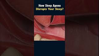 What Sleep Apnea Sounds Like 🥴 deepsleep [upl. by Deach]