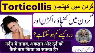 Torticollis گردن میں کھنچاؤ मन्यास्तंभ Homeopathic Treatmennt By Dr Waqar Bhutta In Urdu  Hindi [upl. by Butta]