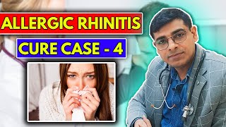 Allergic Rhinitis CURE Case No 4  Homeopathy Treatment for Allergic Rhinitis  Dr Abhik Ghosh [upl. by Nakashima]