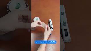 How to cover the normal skin during vitiligo uv treatment vitiligotreatment [upl. by Ahsaeym]