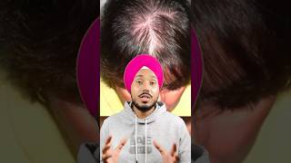 Jatamansi Hair Growth Remedy Natural Solution for Stronger Roots amp Regrowth reducehairfall [upl. by Eirolam]