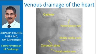 Venous drainage of the heart [upl. by Blynn]