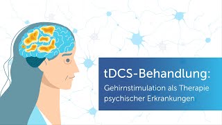 Elektrostimulation bei Depression tDCSTherapie einfach erklärt [upl. by Vally996]