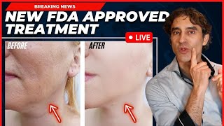 REMOVE JOWLS amp TIGHTEN YOUR FACE WITHOUT SURGERY Everything You Need To Know NEW Approved Procedure [upl. by Rurik]