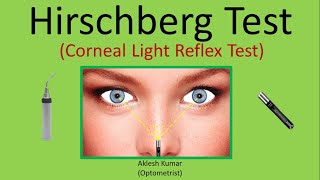 Hirschberg Test  Corneal Light Reflex Test  CLR  HBRT [upl. by Gleeson114]