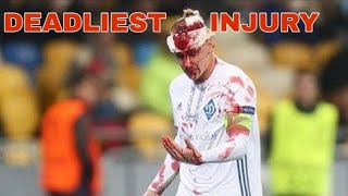 The most DEADLIEST head injury in football Domagoj Vida [upl. by Portwin]