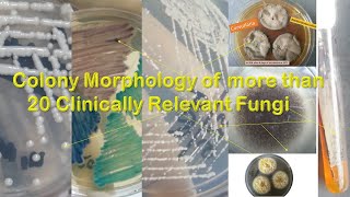 Fungal Colony morphology of more than twenty most common fungi [upl. by Acilgna]