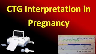 Interpretation of Cardiotocography for Assessment of Fetal Wellbeing NICE Guideline [upl. by Notsniw544]