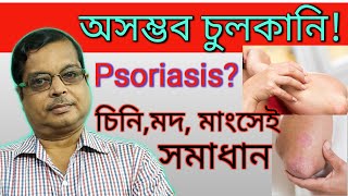 Psoriasis in Bengali  Discussion and Treatment in Homeopathy  সম্পূর্ণ চিকিৎসা  Home remedies [upl. by Aihtela]