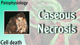 Pathophysiology  Caseous Necrosis Hani Laith شرح [upl. by Annig]