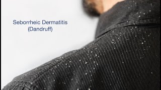 Seborrheic Dermatitis and Hair Loss [upl. by Linzy847]