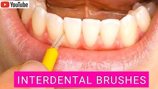 How to Use Interdental Brushes Correctly Top Tips [upl. by Adnir]