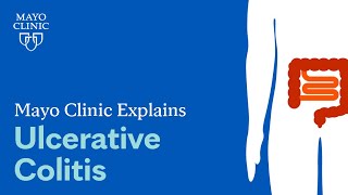 Mayo Clinic Explains Ulcerative Colitis [upl. by Harihat704]