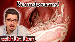 Roundworms in the Dog [upl. by Ynnhoj952]