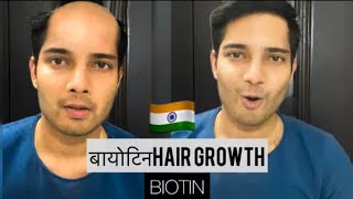 बायोटिन BIOTIN hair growth results before and after Hair growth HAIRFALL REMEDY hairloss Hindi [upl. by Burt161]