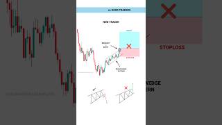 OPTION TRADING PSYCHOLOGY tradingview  Stock  Market  crypto  Trading  shorts [upl. by Guise473]