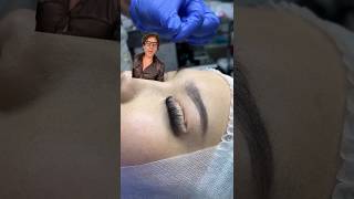 EYELID SURGERY [upl. by Bina]