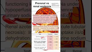 Prerenal vs renal azotemia [upl. by Anett]