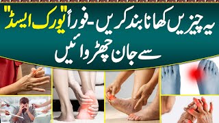 Uric Acid Ka ilaj  Uric Acid Causes Symptom amp Treatment  Diet Plan For Uric Acid amp Foods To Avoid [upl. by Ferren]