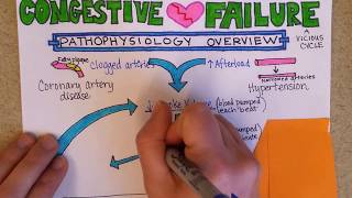 Congestive Heart Failure Pathophysiology [upl. by Arok]