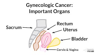 Gynecologic Cancer  What Organs are Impacted [upl. by Cristen881]