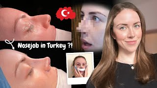 I Got a Nose Job in Istanbul  Turkey Rhinoplasty Vlog 2024 [upl. by Okia]