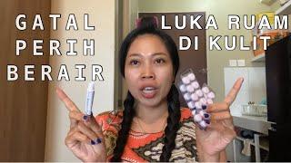 Obat Antivirus Ampuh Acyclovir Tablet Dan Salep [upl. by Dnalra552]